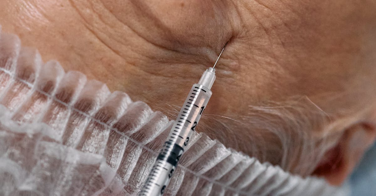 How long do Botox injections usually last?