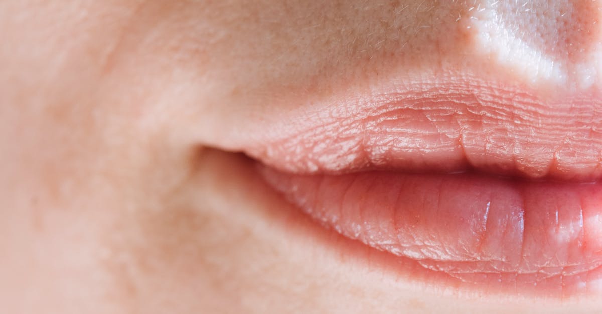 How long does lip augmentation last?